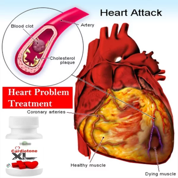 Hashmi Cardiotone-xl Capsules (20 Caps) - Image 2